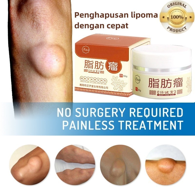 Herbal Lipoma Removal Cream 30 Grams Restrain Lipoma Lump Lipoma Removal Cream Lump Removal Cream Ne