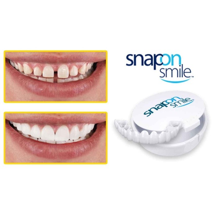 bisa COD Snap On Smile Veneers Gigi Palsu Atas Bawah Original Gigi Satu Set