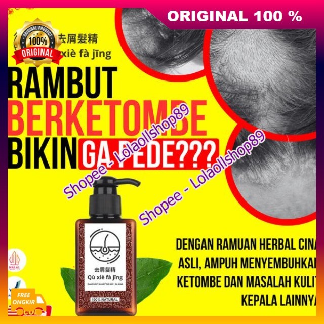 Qu Xi Fa Jing Shampoo Herbal Cina Atasi Ketombe, Rambut Rontok , Lepek, Bercabang Gatal Dan Jamur Am