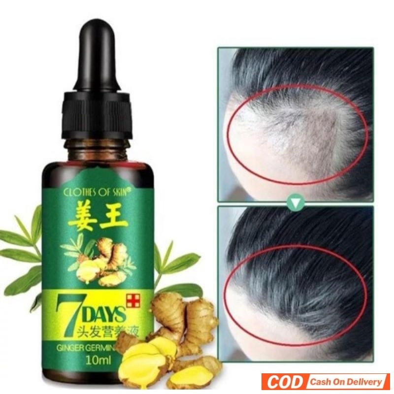 PENUMBUH RAMBUT BOTAK DAN RONTOK PRIA ANAK BAYI CEPAT SERUM ESSENCE Penghitam Uban Penyubur Original