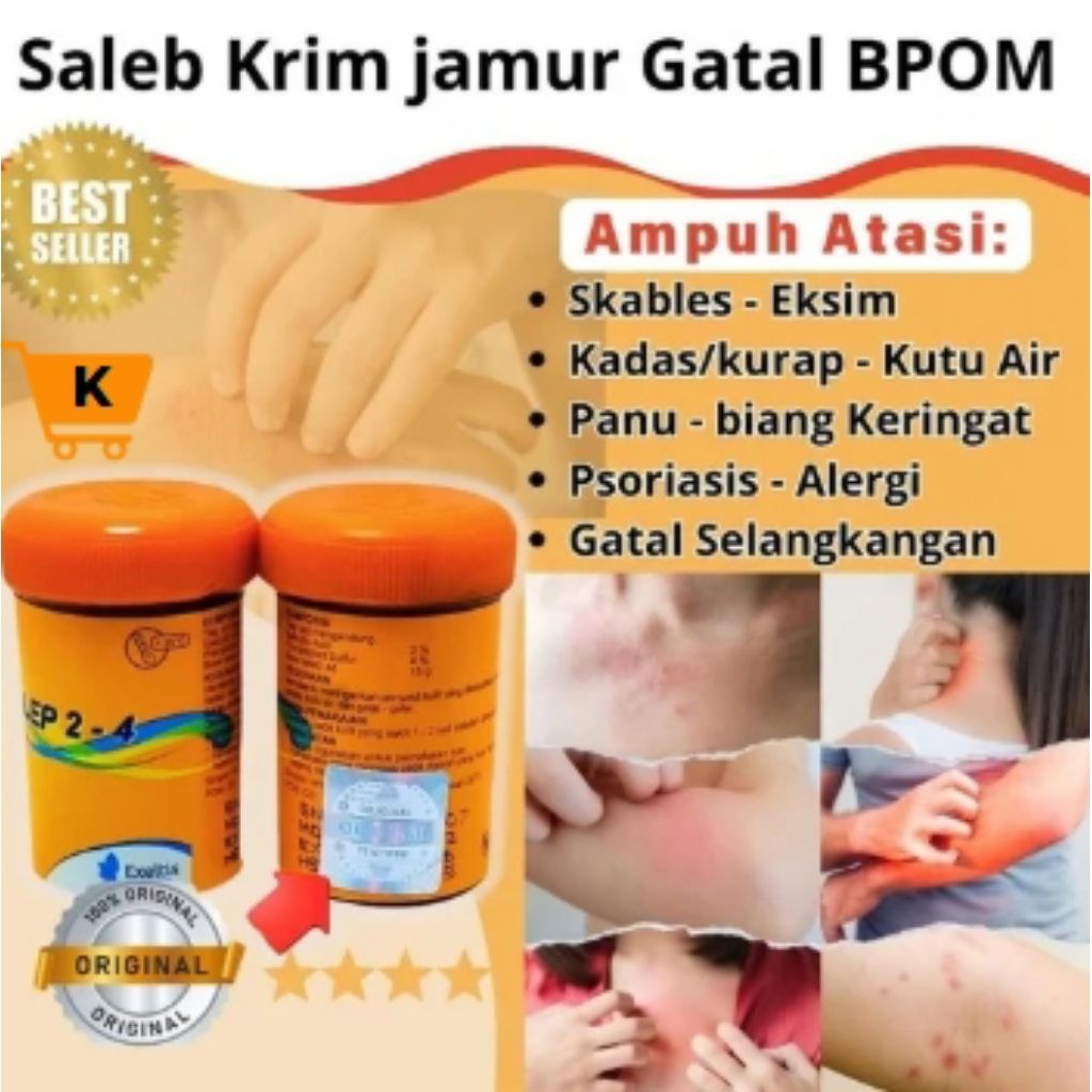 Cito Belerang Salep 2-4 – Atasi Gatal & Ruam