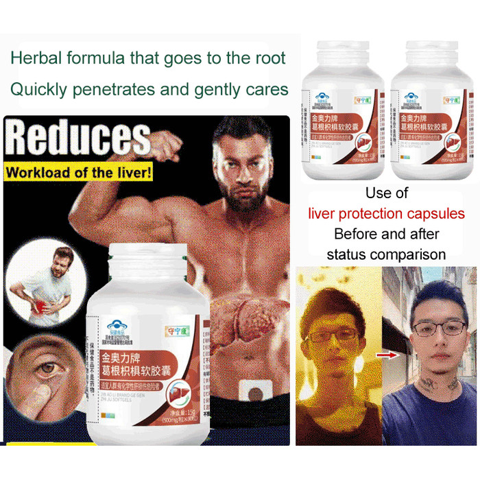 Pueraria Mirifica Liver Capsules Liver Health Foods Pueraria Lobata Tablets Chemical Liver Injury