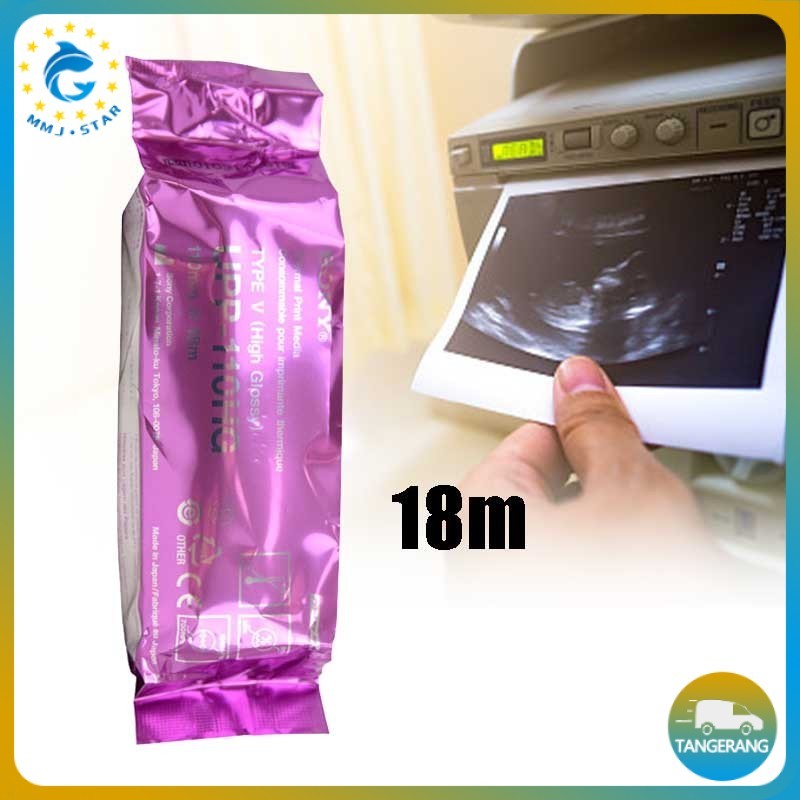 

Kertas USG Sony UPP 110HG Paper Sony Compatibel Printer USG