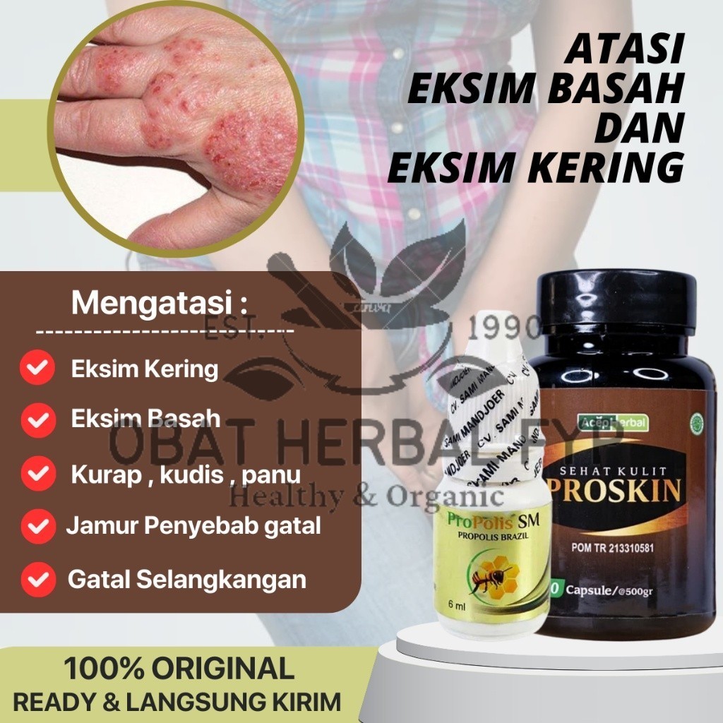 Propolis SM - Obat Eksim Kering Basah, Obat Kurap Kudis Scabies, Salep Obat Gatal Jamur Selangkangan