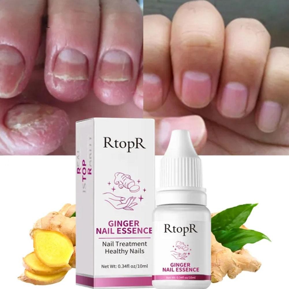 RtopR Nail Lotion Repair Rough Nails Promote Nail Growth