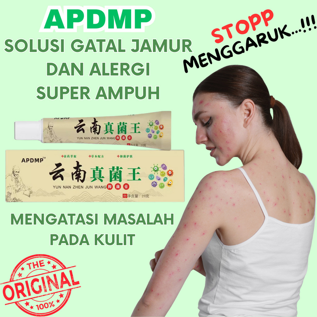 APDMP Salep Gatal Kulit Ampuh Salep Cina Gatel Exim Kulit Salep Psoriasis Eksim