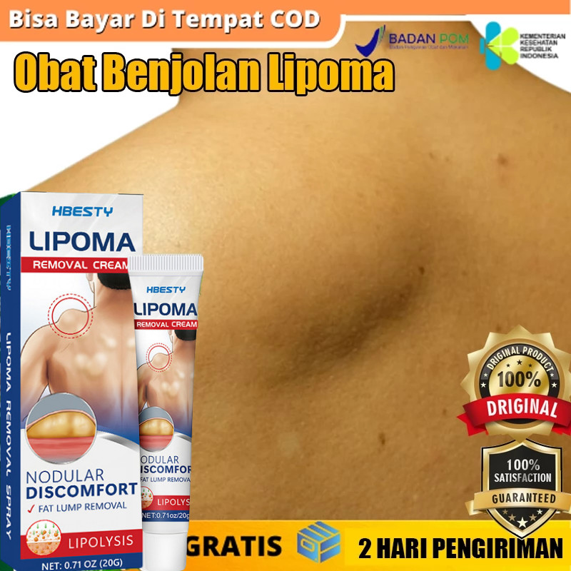 𝗢𝗥𝗜𝗚𝗜𝗡𝗔𝗟 Obat Salep Benjolan Lipoma Obat Benjolan Obat Uci Uci Benjolan Payudara Benjolan Tangan Ben