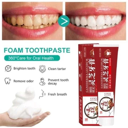 Ganoderma Lucidum Penumbuh Gigi Perbaikan gigi Berlubang Pasta Gigi Pemutih Penghilang Karang Gigi m