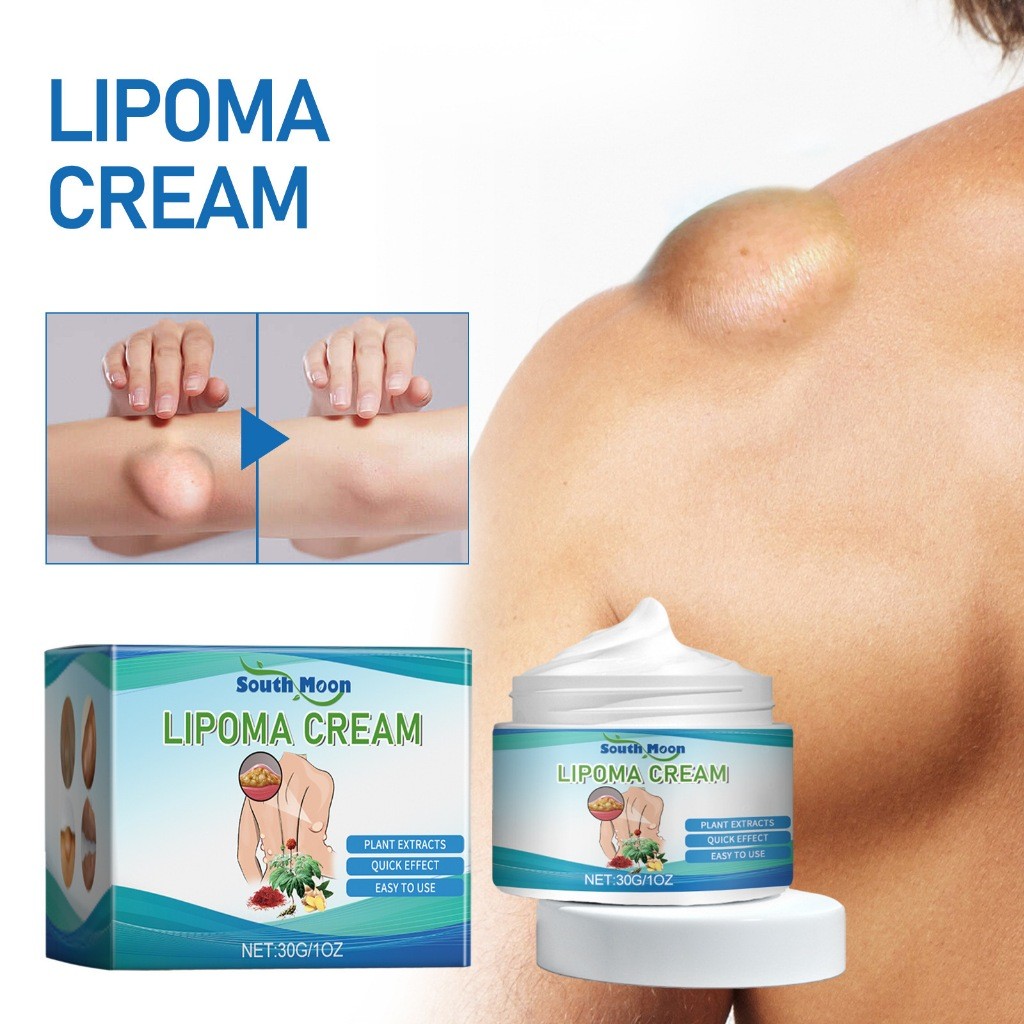 Salep Lipoma Cream Original Obat Benjolan 50g Herbal Cina Krim Obat Benjolan Lipoma Obat salep Lipom