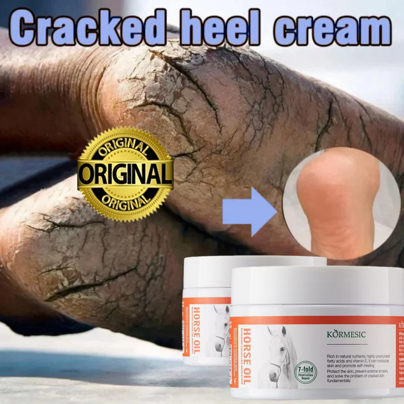 (COD) Cream Pemutih Tangan Dan Kaki KORMESIC Horse Oil Moisture Cream - Horse Oil Moisturiz Hand Cre