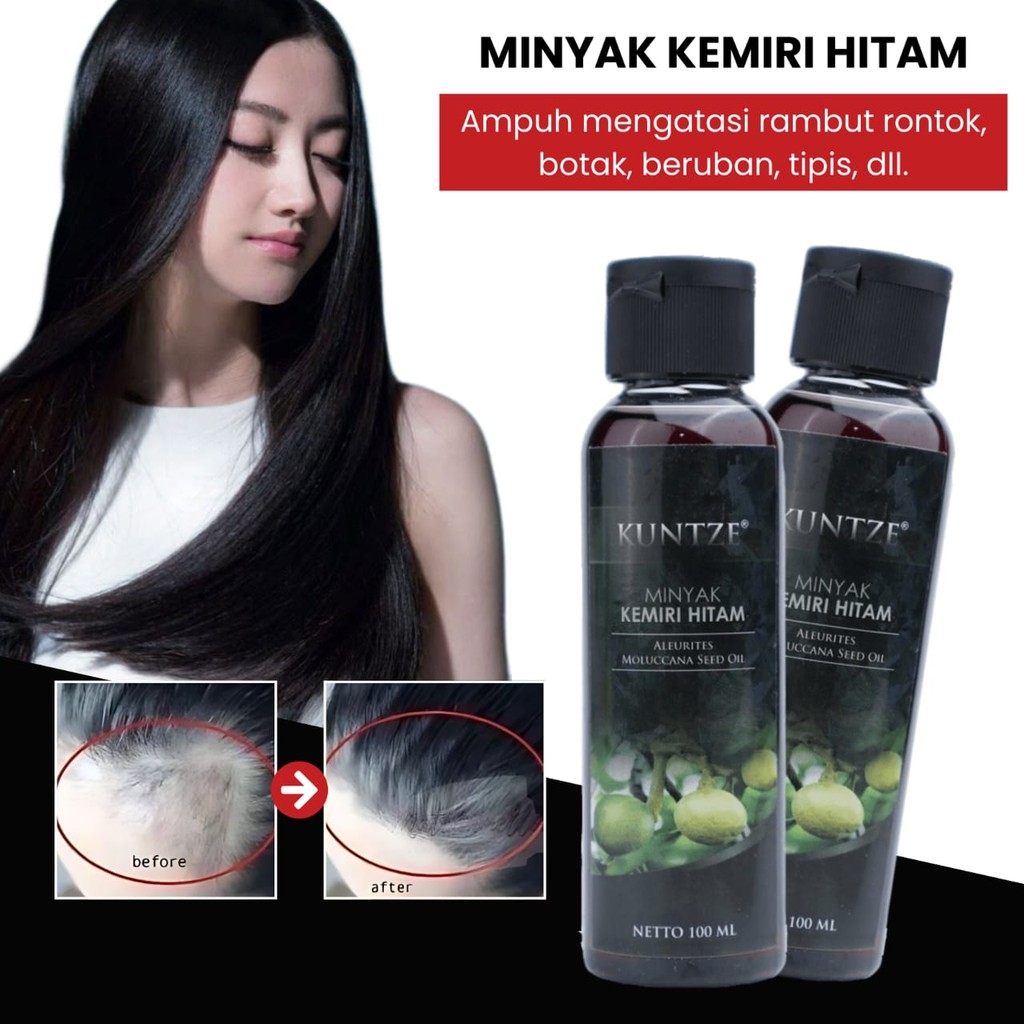 BNS - Kuntze Original BPOM Minyak Kemiri Hitam 100ml - Solusi Alami Untuk Rambut Lebih Tebal & Sehat