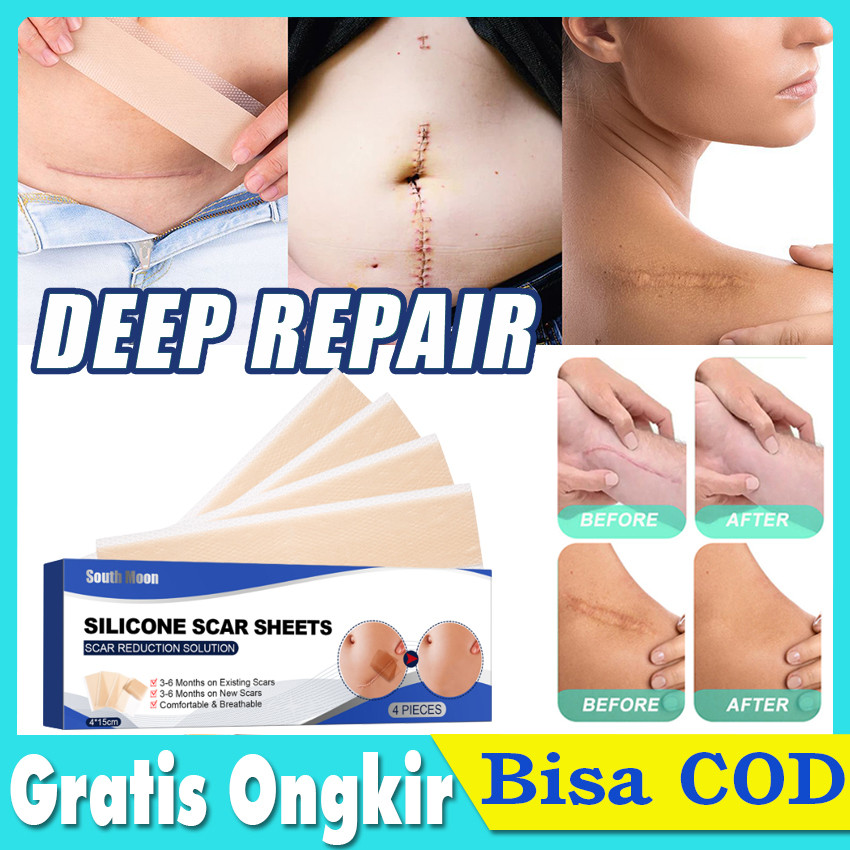 South Moon Silicone Scar Sheet Gel 4PCS 4cm x 7.5cm plester silikon penghilang keloid bekas luka Ple