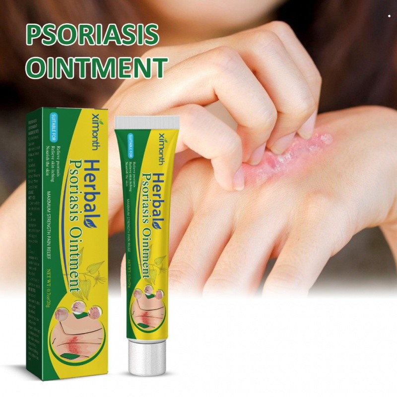 Ximonth Krim Psoriasis 20g Salep Redakan Gatal Kulit Meredakan Kulit Merah, Gatal, Dan Mengelupas Pa
