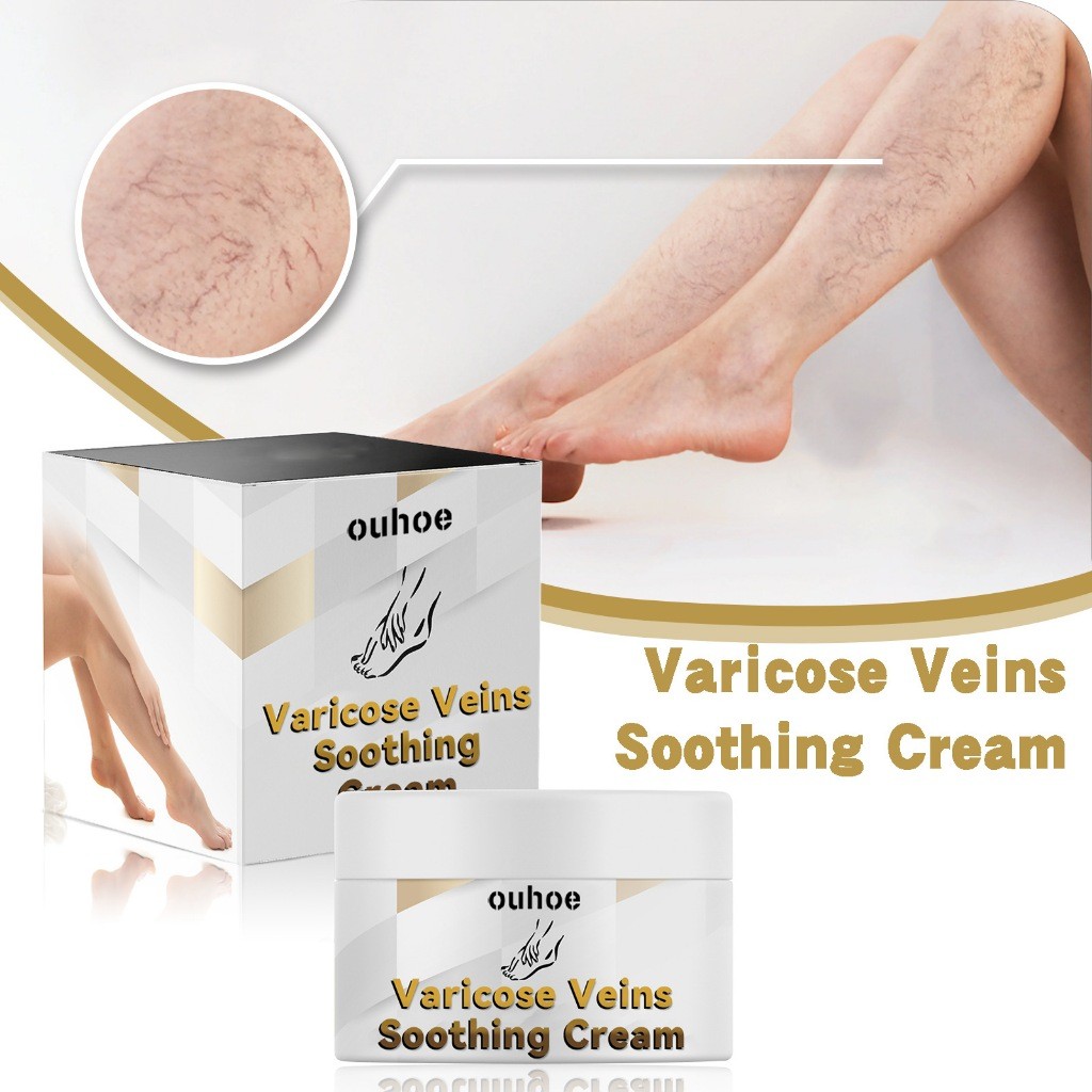 Relief Phlebitis Cream Eliminating Vasculitis Soothing Earthworm Spider Legs Treatment Angiitis Pain