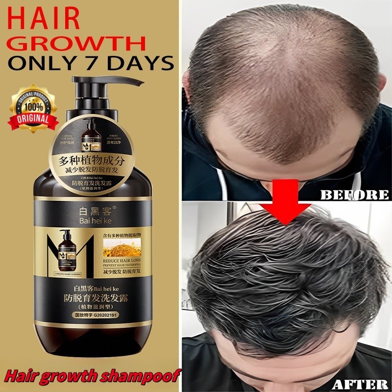 Sampo Penumbuh Rambut Cepat Sampo Penumbuh Rambut Perawatan Rambut Rontok 400ML