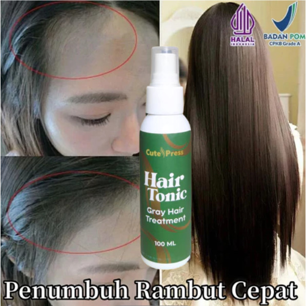 Rambut Penumbuh Rambut Botak Penebal Rambut Penumbuh Rambut Cepat Anti Rontok Rambut Pria Dan Wanita