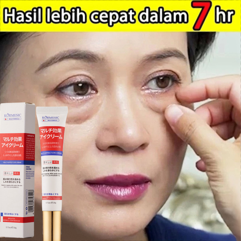 【100% Asli】Krim Mata Anti Keriput Kantung mata Perawatan Kulit Anti-krim kantung mata ampuh-menghila