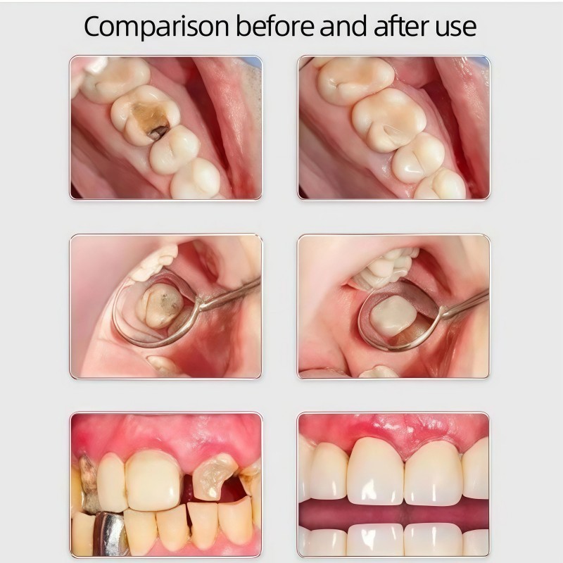 RB22 Obat sakit gigi paling ampuh obat sakit gigi ampuh Obat gigi berlubang Obat sakit gigi anak