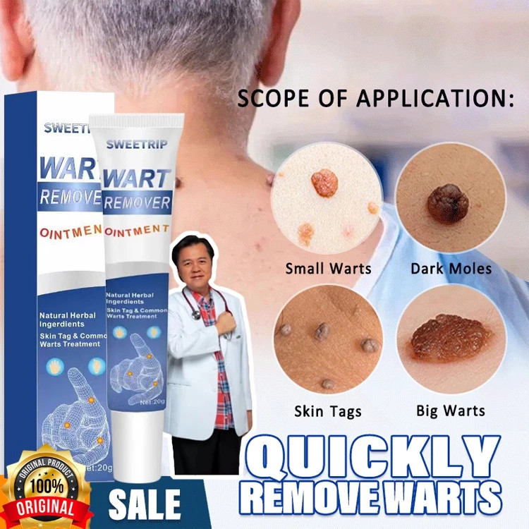 Menghilangkan Kutil Tahi Lalat Penghilang Tahi Lalat Penghilang Kutil Dan Tahi Lalat