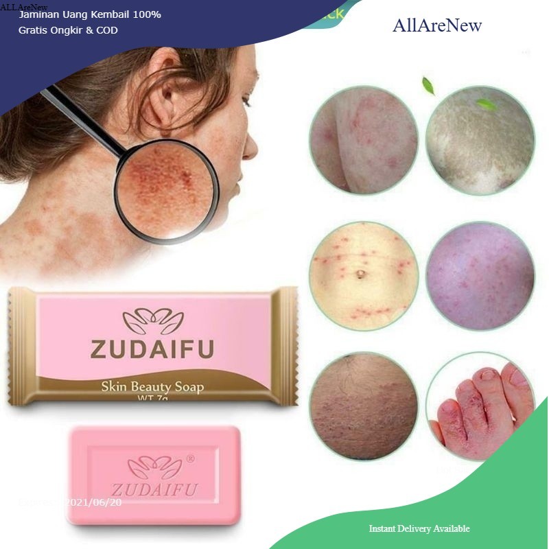 [AllAreNew] Yiganerjing Sabun Sulfur penyakit eksim anti bakteri psoriasis dermatitis kudis kurap pa