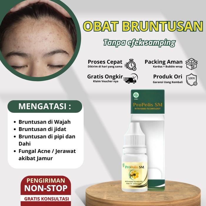 Jerawat Pasir Bruntusan Herbal Penghilang Bruntusan Kecil Di Muka Tetes Penghilang Beruntusan di Jid