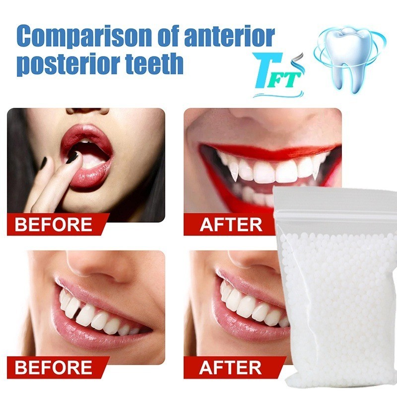 100GR!!Temptooth Gigi Palsu Sementara Temporary Tooth Penambal Gigi Patah Renggang (Asli) Tanpa rasa