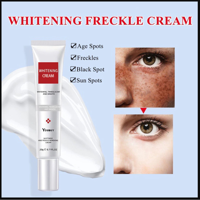 YOUBUY Whitening Blemish Cream Niacinamide Ori Penghilang Flek Hitam Remove Dark Spots