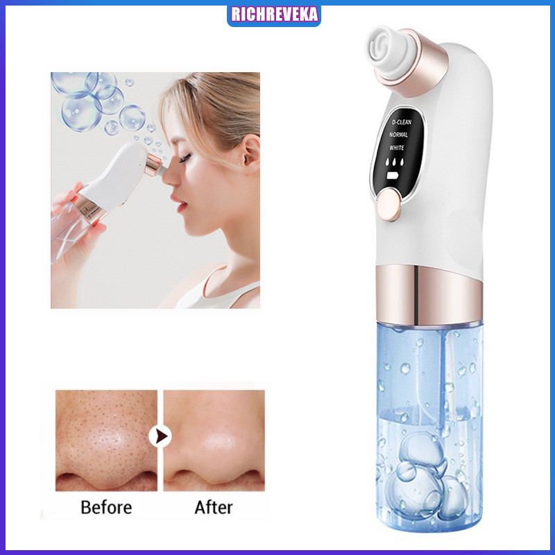Alat penyedot komedo dan jerawat pori-pori/pembersih mikrokristalin komedo vakum/alat kecantikan/kom