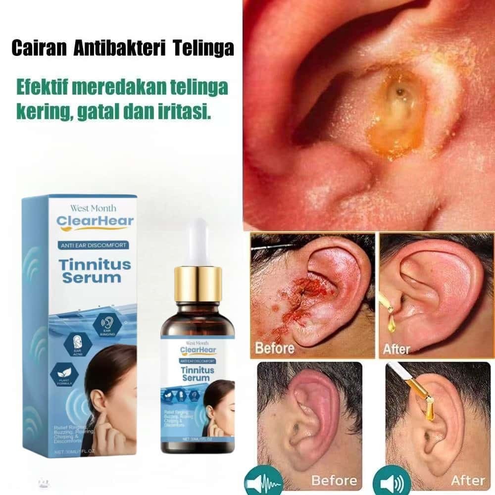 Cairan Obat Tetes Telinga Khusus - Mengatasi Telinga Tuli Permanen, Berdengung, dan Berair, 30ml Pem