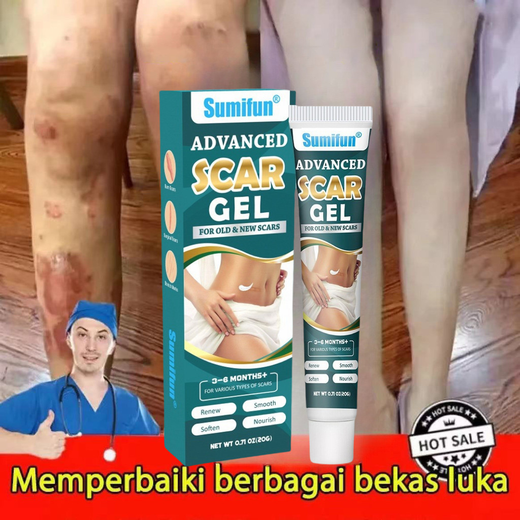 Salep penghilang bekas luka Penghilang bekas luka hitam koreng Obat penghilang bekas luka 20g Menghi