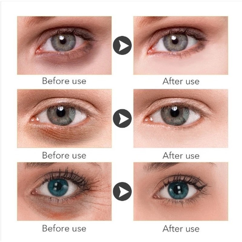 100% AsliKrim Mata Anti Keriput Kantung mata Perawatan Kulit Anti-krim kantung mata