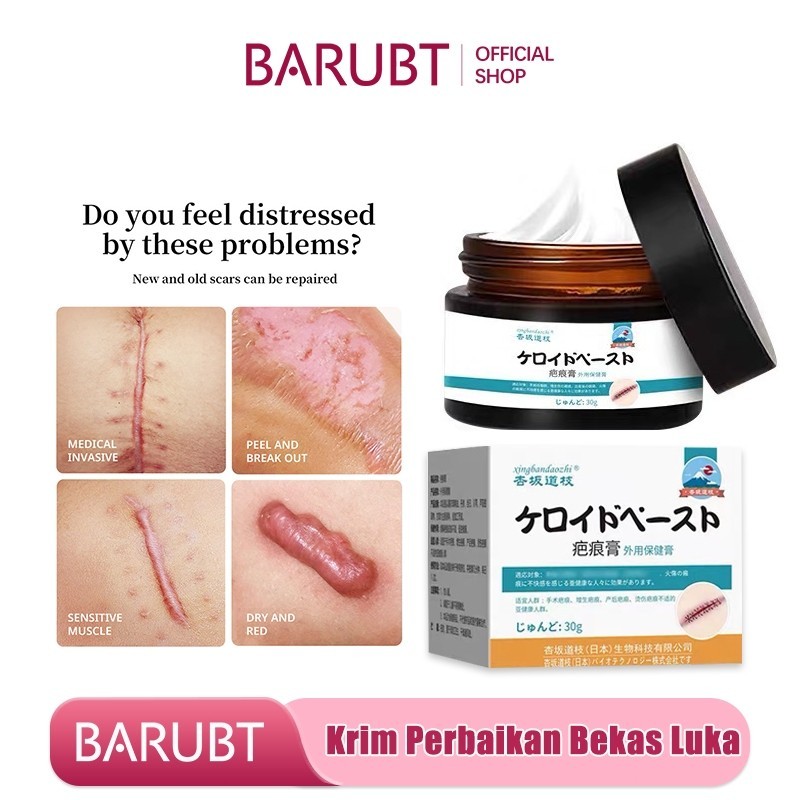 [100% Original] Krim Penghilang Bekas Luka Hitam Obat Penghilang Bekas Luka