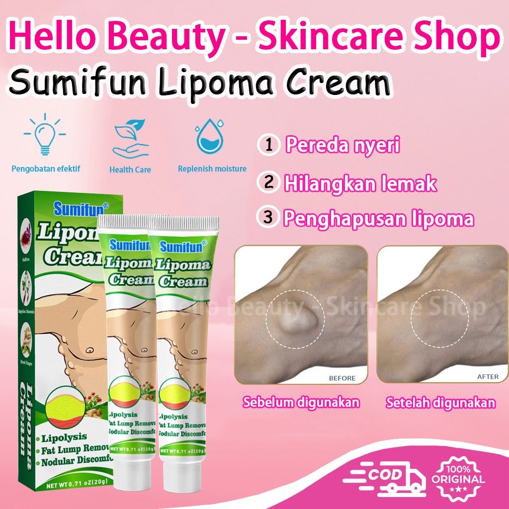 【COD Beli 2 gratis 1】 Lipoma Cream / Sumifun Lipoma Cream / Lipoma Cream Original / Obat benjolan / 