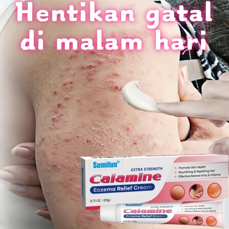 Krim eksim calamine 20g salep gatal selangkangan salep eksim kering paling ampuh salep psoriasis kul