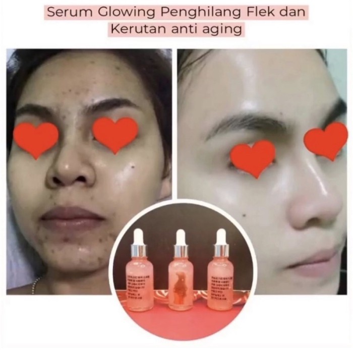 SERUM WAJAH GLOW GLASS SKIN MULGWA KOREA MEMBUAT WAJAH PUTIH CERAH GLOWING MULUS MENGHILANGKAN FLEK 