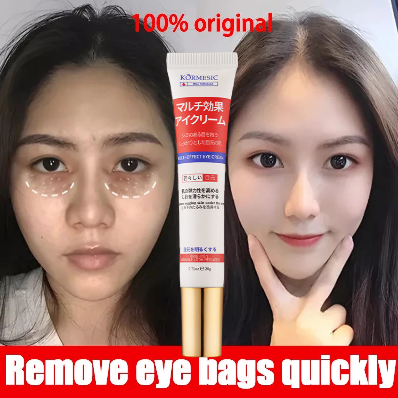 Krim Mata Anti Keriput Kantung mata Perawatan Kulit Anti-krim kantung mata ampuh-menghilangkan mata