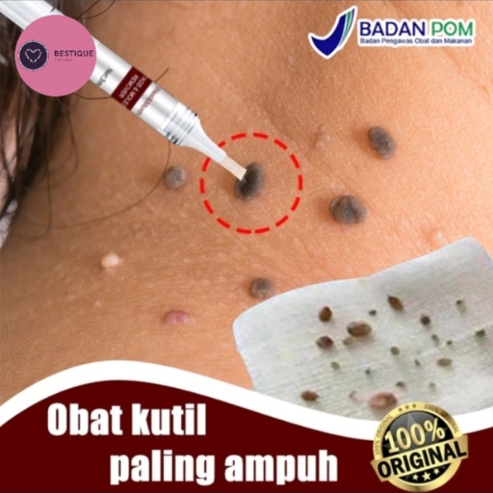 Obat kutil ampuh bintik hitam wart remover original