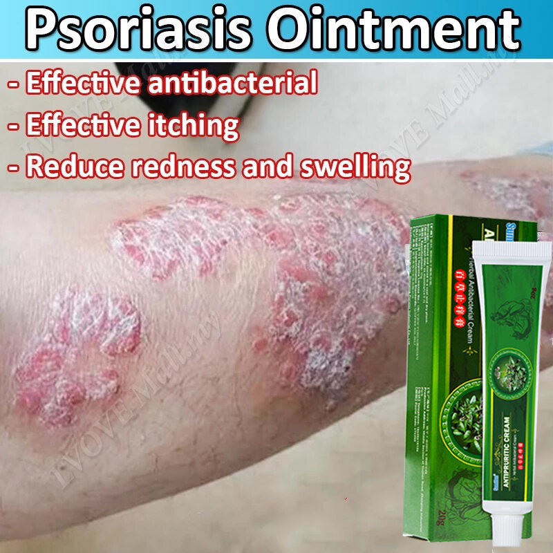 100% Authentic Antibacterial Ointment Relief Itching Remove Wart itching lower body Odor cream Help 
