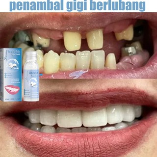 [Ready Stock] penambal gigi berlubang gigi palsu asli dokter permanen tambal gigi permanen 30ML lem 