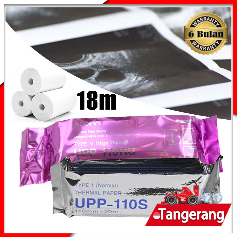 

Paper Usg Sony UPP-110HG / Printer Sony / Kertas Thermal 110mm x 18m