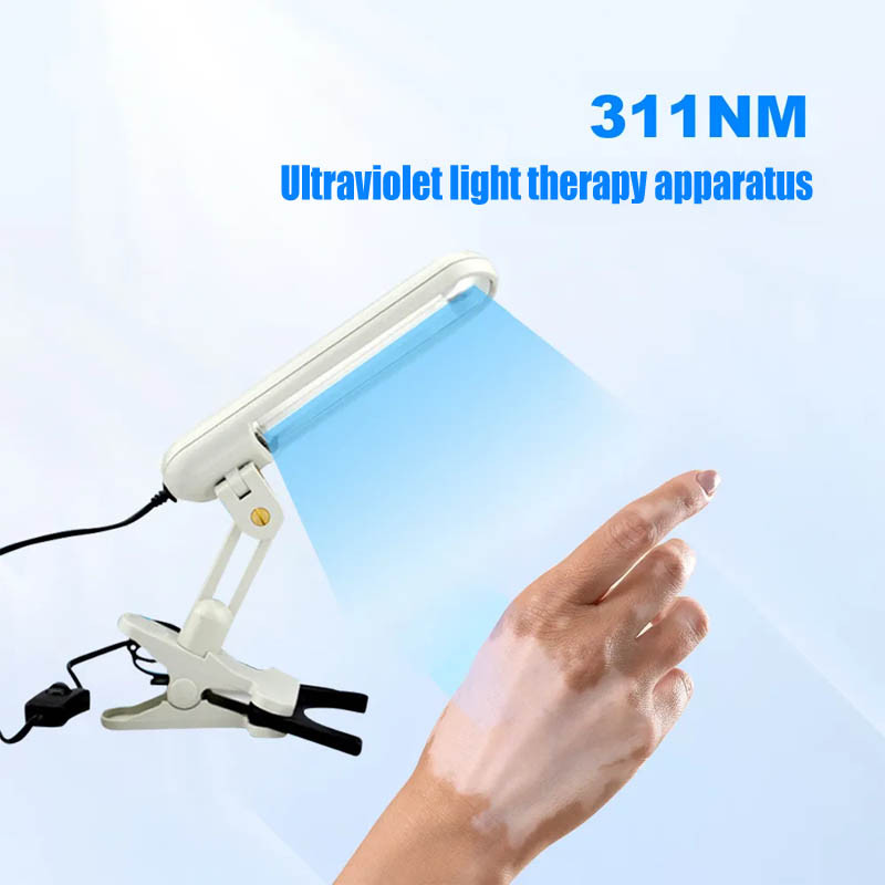 311NM UVB Lamp Phototherapy For Vitiligo Psoriasis Treatment 311nm Psoriasis Laser UV Treatment Home