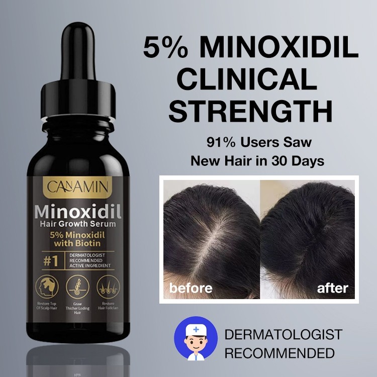 DailyyUStore - [100% Ori] Hair Growth Serum Minoxidil 5% Pertumbuhan Rambut Cepat 30mlRambut Rontok
