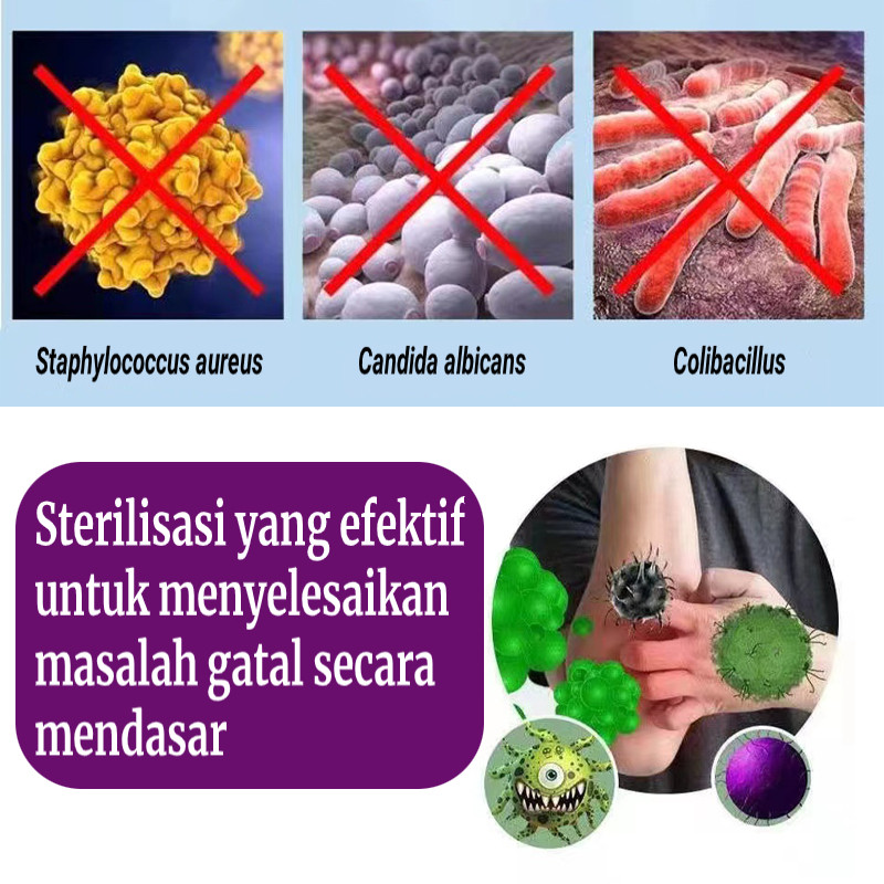 Salep gatal salep china gatal paling ampuh obat gatal obat eksim salep gatal selangkangan 30g Obat