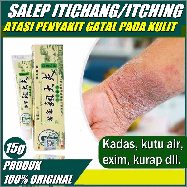 Promo salep iticang cream salep itching obat salep gatal kulit kutu air salep alergi kulit gatal kur