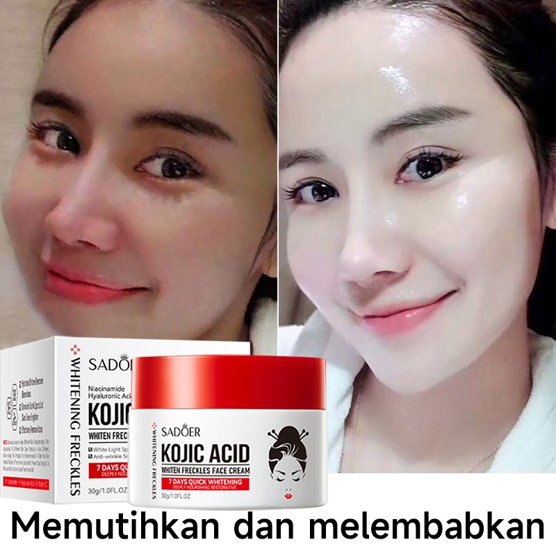 Kojic Acid Whitening Freckle Cream 30g Moisturizing Penghilang Flek Hitam membandel Krim Penghilang 