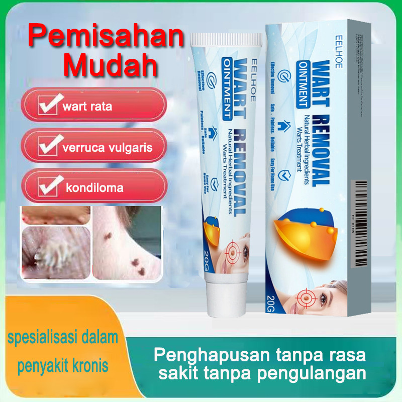 Salep Penghilang Kutil  Krim Perawatan Kutil Penghilang Kutil Ekstrak Herbal Penghilang Pertumbuhan 