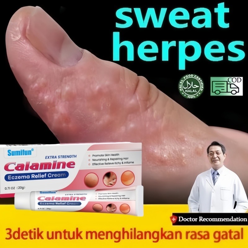 Krim Eksim Kalamine Sumifun Krim psoriasis paling ampuh untuk psoriasis kulit kepala, psoriasis tang