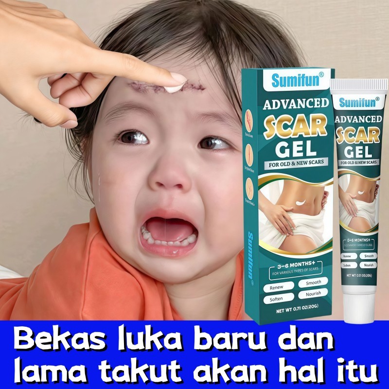 Krim Bekas Luka Sumifun 20g merawat, menghilangkan dan mencerahkan bekas luka bakar, bekas luka oper