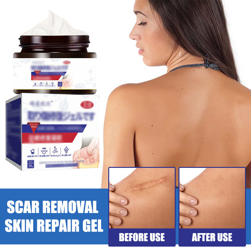 [COD]Gel Perbaikan Kulit Gel Perbaikan Ringan untuk Bekas Luka Bedah dan Luka Bakar-KY