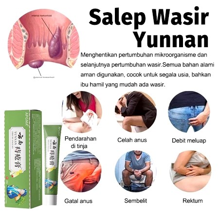 Yunnan Obat Fistula Ani Bisul Di Pantat Bernanah Ampuh Abses Perianal Herbal
